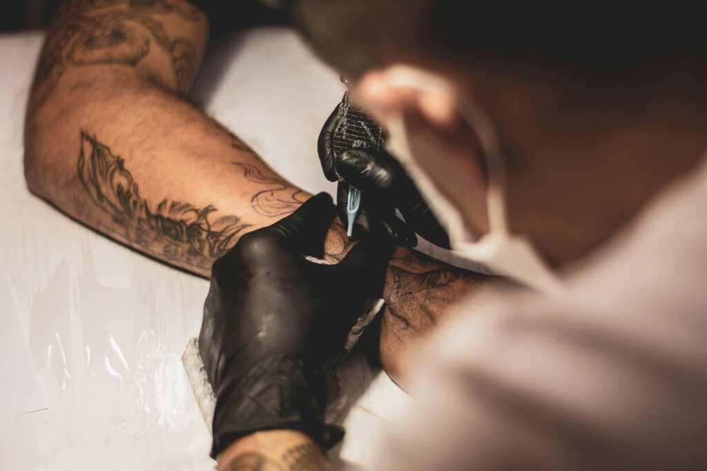 Tattoo Removal Methods Comparing Modern Techniques